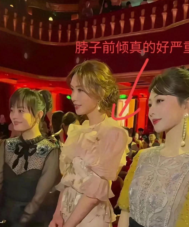 惊！林志玲下嫁 6 年后大变样，“日化” 显著体态畏畏缩缩
